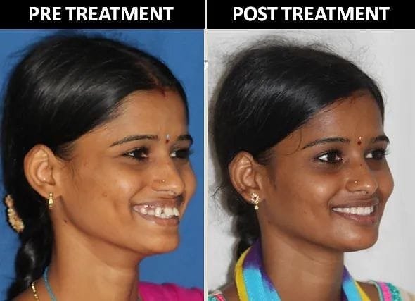 Comfortable reception area at Lepakshee Dental Care